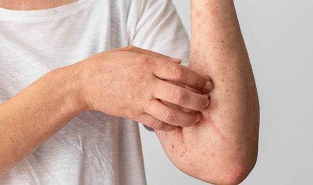 Türkiye Ulusal Alerji ve Klinik İmmünoloji Derneği Yönetim Kurulu Üyesi