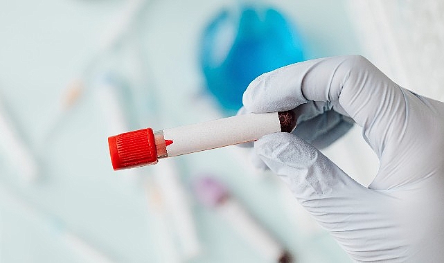Sepsis; hem dünyada hem de ülkemizde sağlıkla ilgili sorunlar arasında