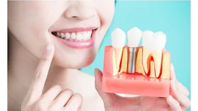 Diş kaybı yaşayan bireylerin estetik ve fonksiyonel ihtiyaçlarını karşılamak için