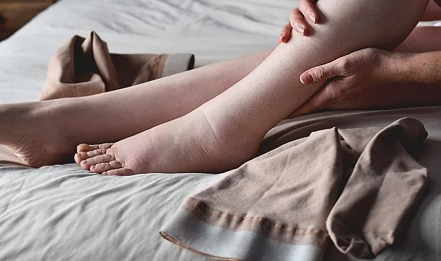 Özellikle kadınları daha fazla etkileyen lipödem obezite ile karıştırılabiliyor. Beslenme