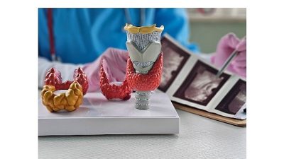 Tiroit ultrasonlarında sıkça görülen ancak çoğu kişinin adını bile duymadığı