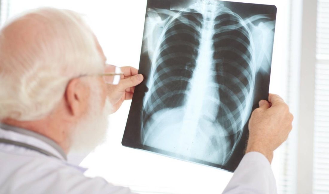 Türkiye Ulusal Solunum Koalisyonu’ndan Sağlıklı Nefes İçin Ortak Çağrı