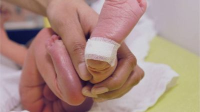 Hastalara büyük umut doğdu: Modülatör İlaçlar SGK Kapsamında