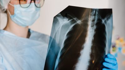 Hastalık, tüm dünyada önde gelen ölüm nedenlerinden biri olup bu