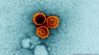 Multipl skleroza, neredeyse herkesin vücudunda bulunan bir virüs neden oluyor.