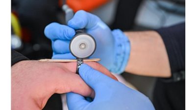 İzmir İtfaiyesi paramedikleri, cisim batması ve yüzük sıkışması gibi yüksek