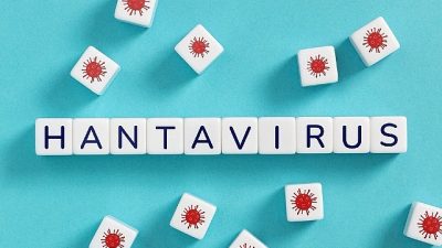 Enfeksiyon Hastalıkları ve Klinik Mikrobiyoloji Uzmanı Prof. Dr. Meral Sönmezoğlu,